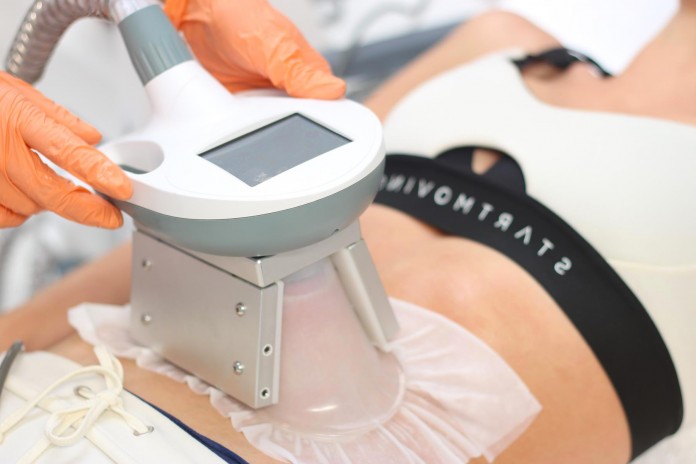 Cryolipolyse : est-ce possible de maigrir avec le froid ?