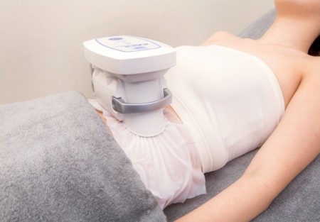 procédure cryolipolyse